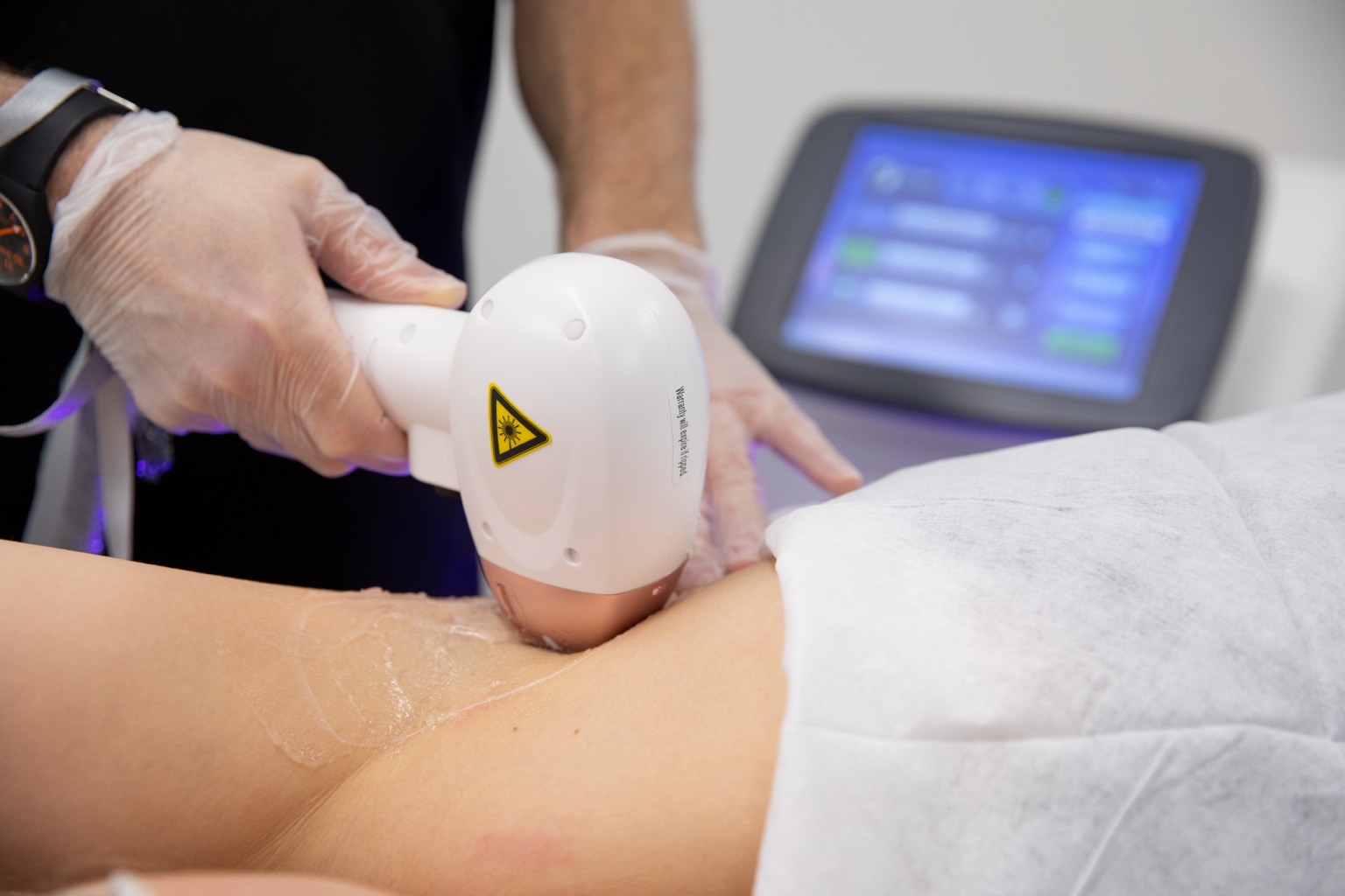 Laser hair removal treatment using a handheld applicator
